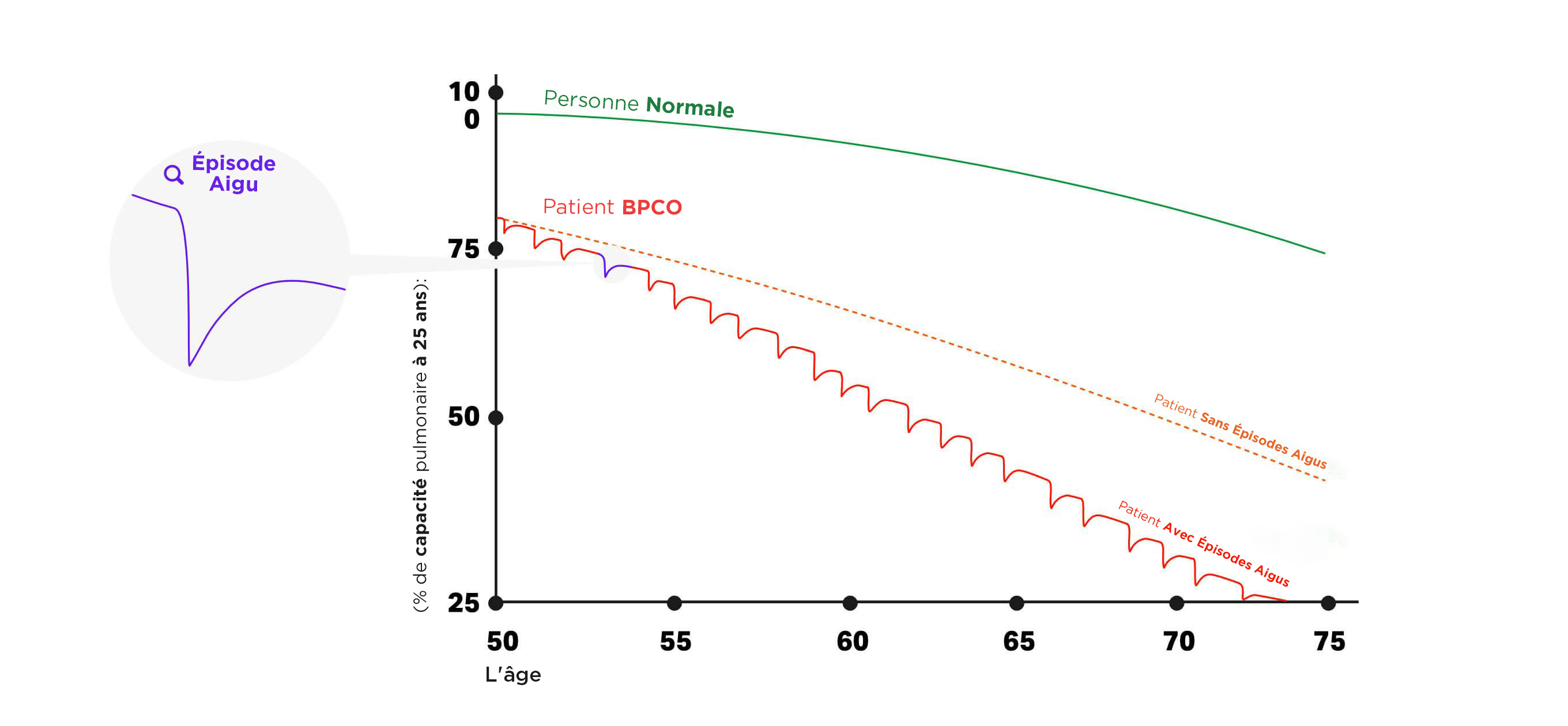 Graphique sur l'évolution de la capacité pulmonaire en BPCO